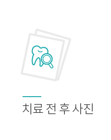 치료전후사진