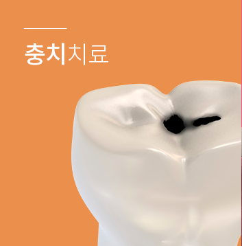 충치치료